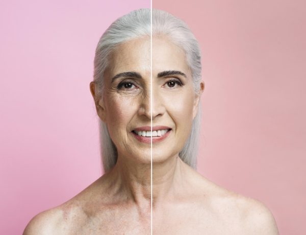 Facelift Procedures On Skin Health